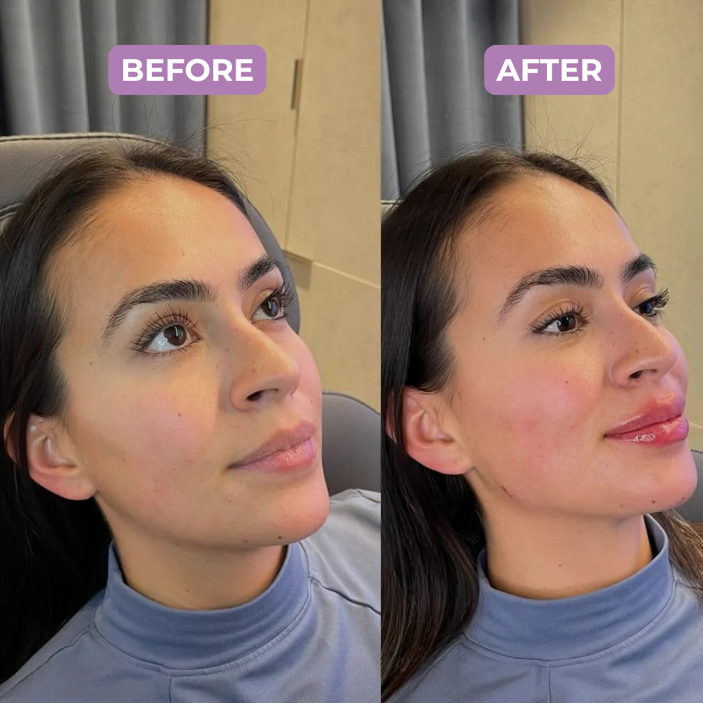 Lumelia - Face Sculpting Ritual Kit
